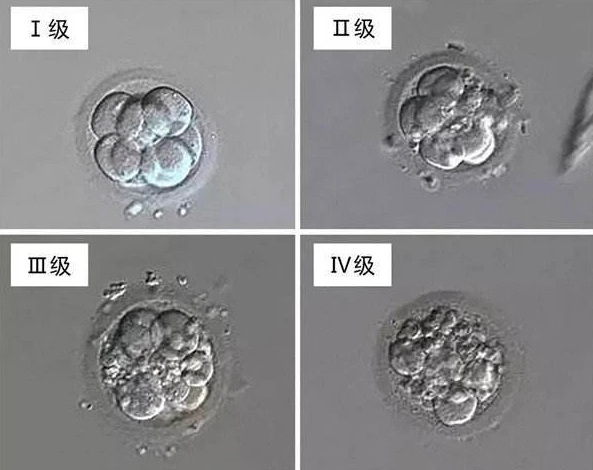 做试管移植A级胚胎为什么还是失败？